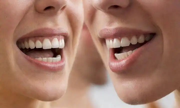 2 filas de dientes lado a lado, humanos a la izquierda, gato a la derecha, formas contrastantes y tamaños, caninos e incisivos destacados, encías y bocas no visibles