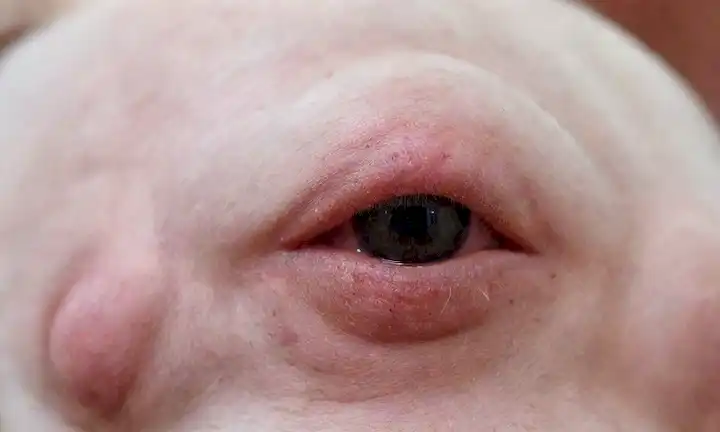 Un disparo de cerca de una piel de perros con varias erupciones